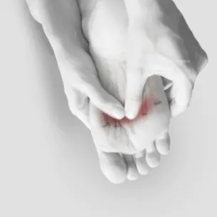 Metatarsalgia treatment in St Catharines and Niagara Region