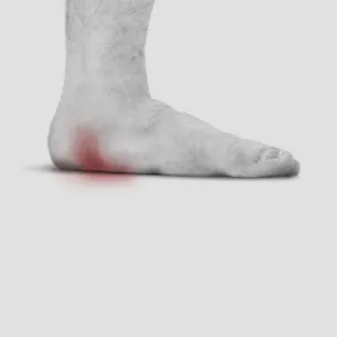 Posterior Tibial Tendonitis treatment in St Catharines and Niagara Region